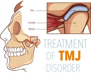 Different components of the temporomandibular joint (TMJ)